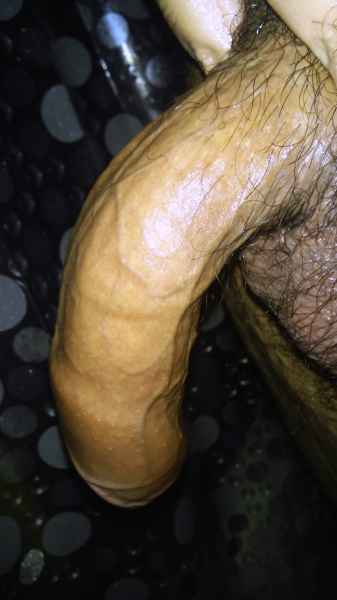 bent penis