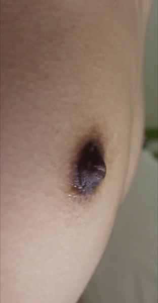Sever เป็นอะไรคับ.ไมไม่ up​ รูปเลย​ คับ