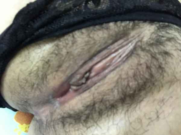 ?????